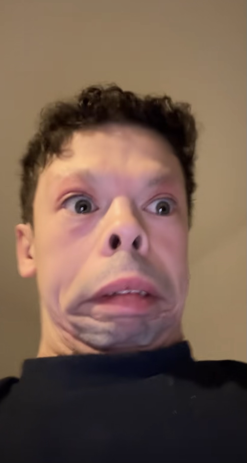 RumpelForeskin